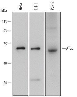Human/Mouse/Rat ATG5 Antibody, R D Systems 25&mu;g; Unlabeled:Antibodies,