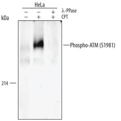 Human/Mouse/Rat Phospho-ATM (S1981) Antibody, R D Systems 100 &mu;g | Buy Online | R&D Systems | Fisher Scientific