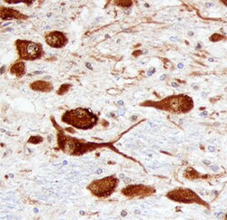 Human/Mouse ATN1 Antibody, R D Systems 25&mu;g; Unlabeled:Antibodies, Polyclonal