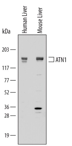 Human/Mouse ATN1 Antibody, R D Systems 25&mu;g; Unlabeled:Antibodies, Polyclonal