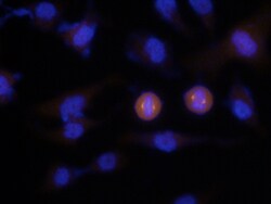 Human Aurora A Biotinylated Antibody, R D Systems 50&mu;g; Biotin:Antibodies,