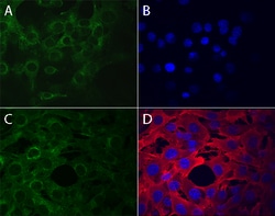 Human Phospho-Axl (Y779) Antibody, R D Systems 100&mu;g; Unlabeled:Antibodies,