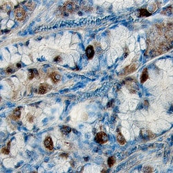 Human Phospho-Axl (Y779) Antibody, R D Systems 100&mu;g; Unlabeled:Antibodies,