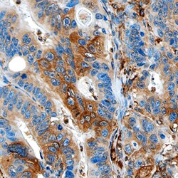 Human PD-L1 Antibody, R D Systems 100ug; Unlabeled:Antibodies, Monoclonal