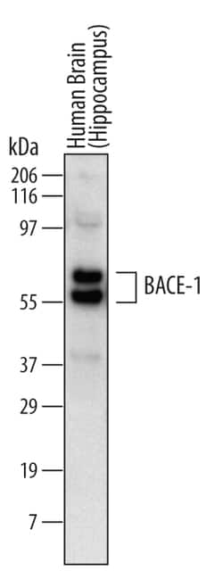 Human/Mouse BACE-1 Ectodomain Antibody, R D Systems:Antibodies:Primary
