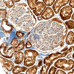 Human Bad Antibody, R D Systems 100ug; Unlabeled:Antibodies, Monoclonal