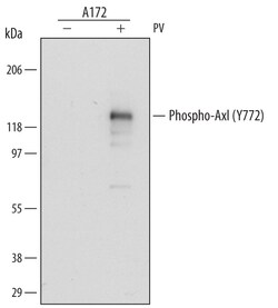 Human Phospho-Axl (Y779) Antibody, R D Systems 25 &mu;g | Buy Online | R&D Systems | Fisher Scientific