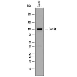 Human BANK1 Antibody, R D Systems 100&mu;g; Unlabeled:Antibodies, Polyclonal