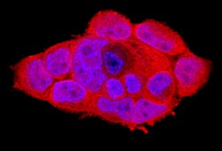 Human Bcl-10 Antibody, R D Systems 100&mu;g; Unlabeled:Antibodies, Polyclonal