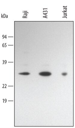 Human Bcl-10 Antibody, R D Systems 100&mu;g; Unlabeled:Antibodies, Polyclonal