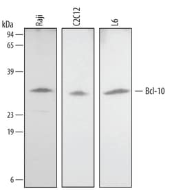 Human/Mouse/Rat Bcl-10 Antibody, R D Systems 100ug; Unlabeled:Antibodies,