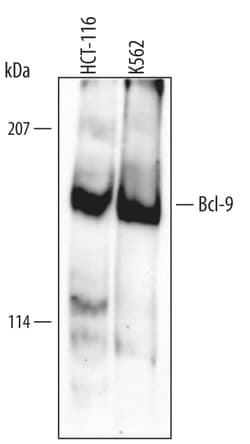 Human Bcl-9 Antibody, R D Systems 25 &mu;g | Buy Online | R&D Systems | Fisher Scientific