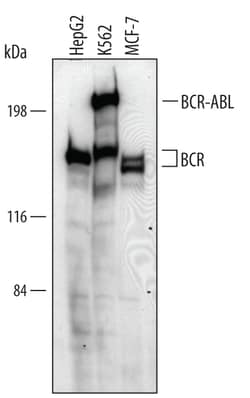 Human BCR Antibody, R D Systems 25&mu;g; Unlabeled:Antibodies, Polyclonal