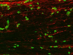 Human BDNF Antibody, R D Systems 100&mu;g; Unlabeled:Antibodies, Polyclonal