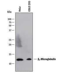 Human beta 2-Microglobulin Antibody, R D Systems 100ug; Unlabeled:Antibodies,