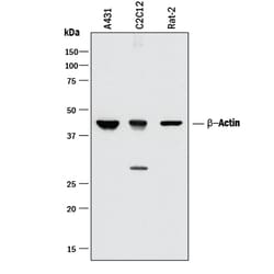 beta-Actin Mouse anti-Human, Mouse, Rat, Clone: 937215, R D Systems 25&mu;g;