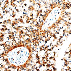 Human Betacellulin/BTC Antibody, R D Systems 100&mu;g; Unlabeled:Antibodies,