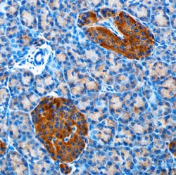 Human Betacellulin/BTC Antibody, R D Systems 25&mu;g; Unlabeled:Antibodies,