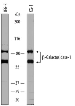 Human beta-Galactosidase-1/GLB1 Antibody, R D Systems 25&mu;g; Unlabeled:Antibodies,