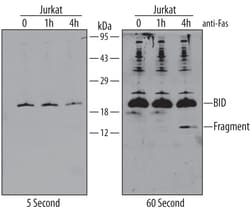 Human/Mouse BID Antibody, R D Systems 100&mu;g; Unlabeled:Antibodies, Polyclonal