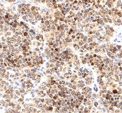 Human BIK Antibody, R D Systems 25&mu;g; Unlabeled:Antibodies, Polyclonal