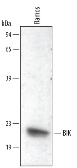 Human BIK Antibody, R D Systems 25&mu;g; Unlabeled:Antibodies, Polyclonal