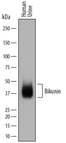 Bikunin Sheep anti-Human, Polyclonal, R D Systems 25&mu;g; Unlabeled, Quantity: