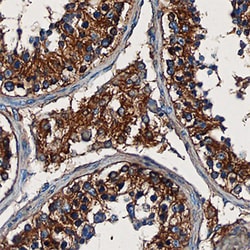 Human BLMH/Bleomycin Hydrolase Antibody, R D Systems 100ug; Unlabeled:Antibodies,