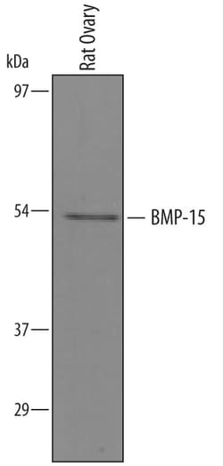 Mouse/Rat BMP-15/GDF-9B Antibody, R D Systems 100&mu;g; Unlabeled:Antibodies,