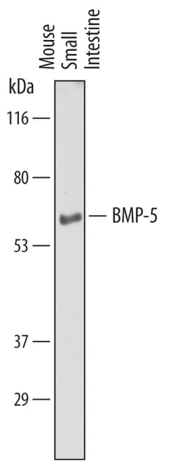 Mouse BMP-5 Antibody, R D Systems 25&mu;g; Unlabeled:Antibodies, Polyclonal