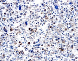 Human BMP-8 Antibody, R D Systems 100&mu;g; Unlabeled:Antikörper