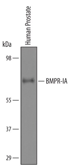 Human BMPR-IA/ALK-3 Antibody, R D Systems 25&mu;g; Unlabeled:Antibodies,