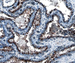 Human BMPR-IA/ALK-3 Antibody, R D Systems 100ug; Unlabeled:Antibodies,