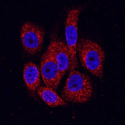 Human BMPR-IB/ALK-6 Antibody, R D Systems 100ug; Unlabeled:Antibodies,