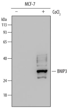 Human BNIP3 Antibody, R D Systems 100ug; Unlabeled:Antibodies, Monoclonal