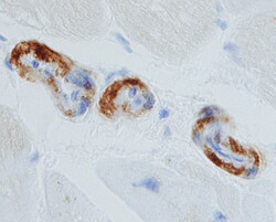 Human Pro-BNP Antibody, R D Systems 100ug; Unlabeled:Anticorps, Monoclonal