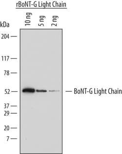 BoNT-G Light Chain Sheep anti-C. botulinum, Polyclonal, R D Systems 100&mu;g;