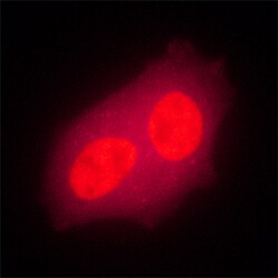 Human Bora Antibody, R D Systems 25&mu;g; Unlabeled:Antibodies, Monoclonal