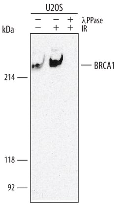 Human Phospho-BRCA1 (S1423) Antibody, R D Systems 100&mu;g; Unlabeled:Antibodies,