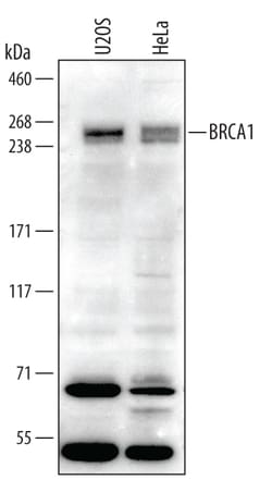 Human BRCA1 N-Terminus Antibody, R D Systems 25&mu;g; Unlabeled:Antibodies,