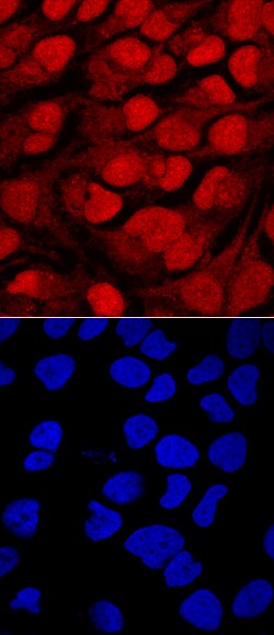 Human Brg1 Antibody, R D Systems 25&mu;g; Unlabeled:Antibodies, Polyclonal