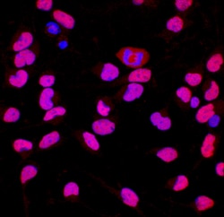 Human Brg1 Antibody, R D Systems 25&mu;g; Unlabeled:Antibodies, Polyclonal
