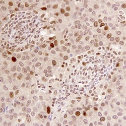 Human BRIP1/FANCJ Antibody, R D Systems 100ug; Unlabeled:Antibodies, Monoclonal