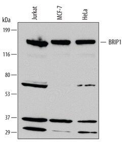 Human BRIP1/FANCJ Antibody, R D Systems 100ug; Unlabeled:Antibodies, Monoclonal