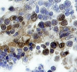 Human Brk Antibody, R D Systems 100&mu;g; Unlabeled:Antibodies, Polyclonal