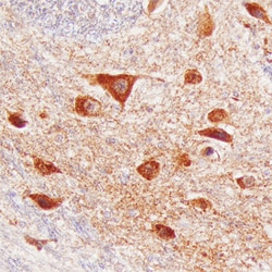 Human Brorin/VWC2 Antibody, R D Systems 100&mu;g; Unlabeled:Antibodies,