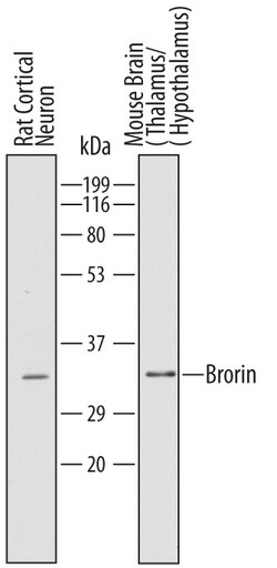 Mouse Brorin/VWC2 Antibody, R D Systems 100 &mu;g | Buy Online | R&D Systems | Fisher Scientific
