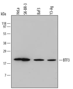 Human/Mouse/Rat BTF3 Antibody, R D Systems 25&mu;g; Unlabeled:Antibodies,