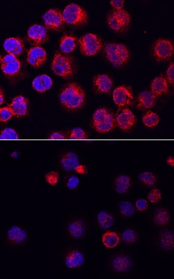 Human Phospho-BTK (Y223) Antibody, R D Systems 100ug; Unlabeled:Antibodies,