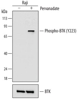 Human Phospho-BTK (Y223) Antibody, R D Systems 100ug; Unlabeled:Antibodies,